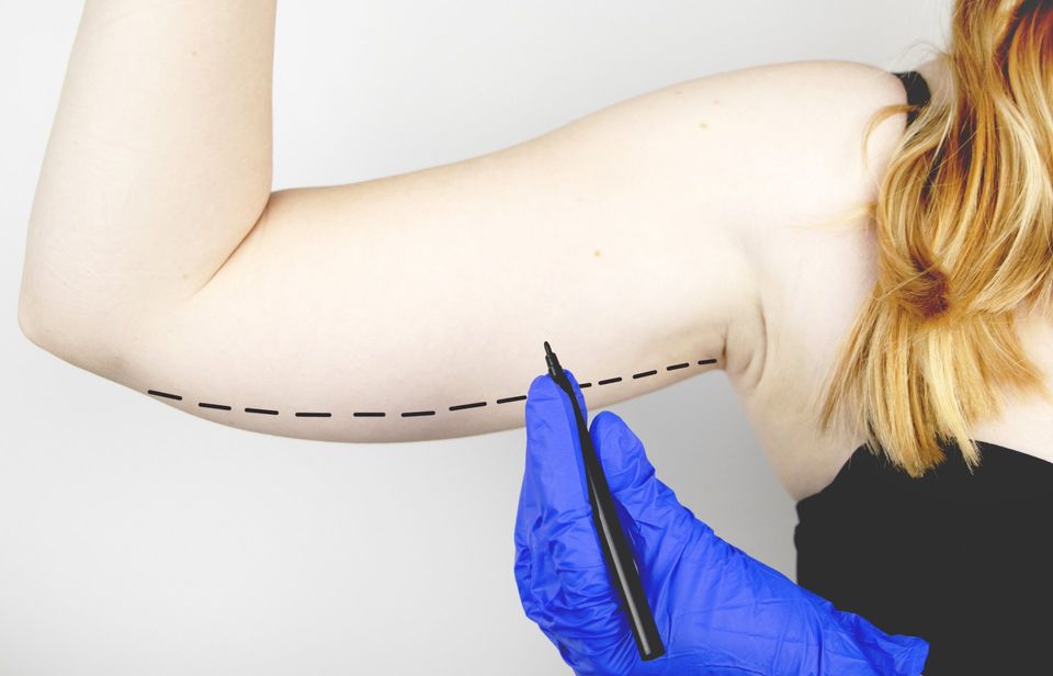 Plastic Surgery — Brachioplasty in Saginaw, MI