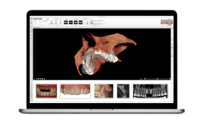 Riproduzione 3D della bocca