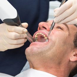 Restauro innovativo Cerec