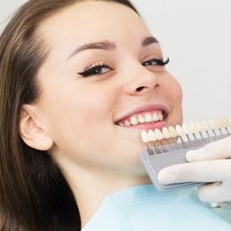 Sbiancamento dentale