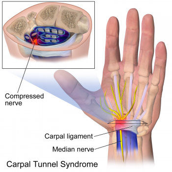 Carple Tunnel