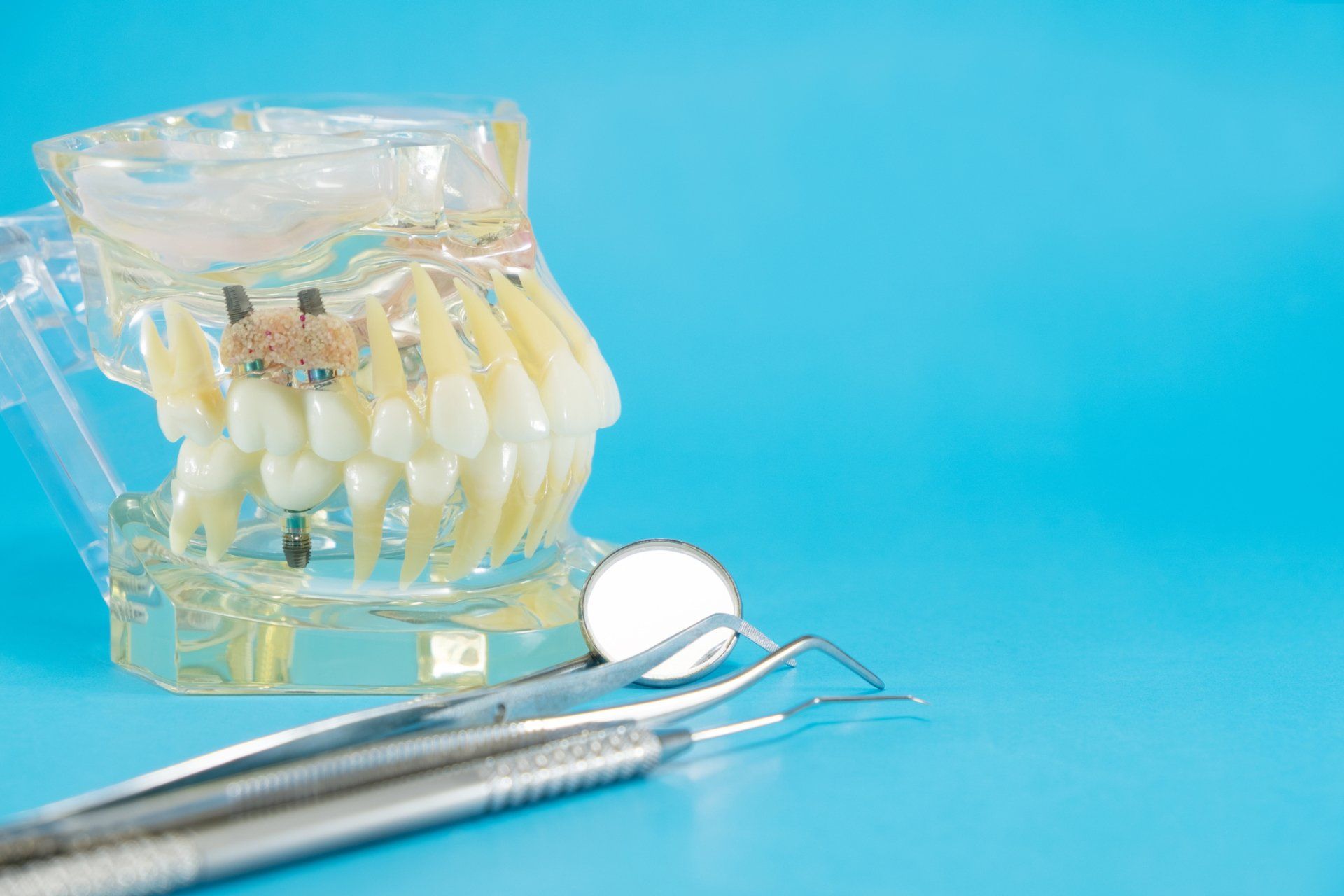 Dental model with tools on a blue background.