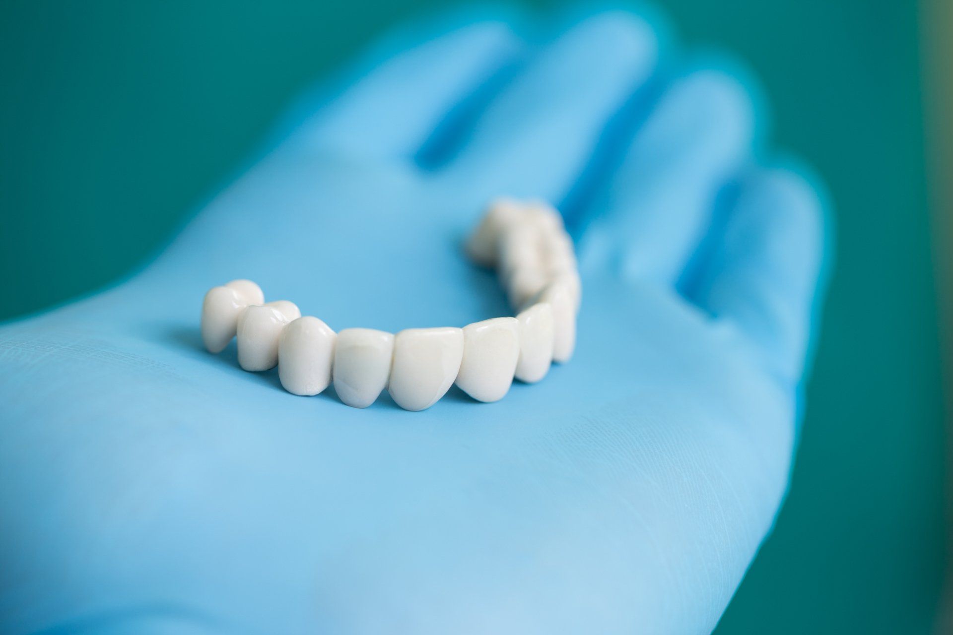 Crown and bridges at General Dentistry at Scott Family Dentistry | Benton, AR