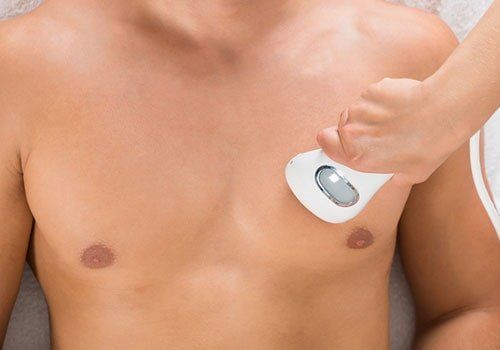 Laser Epilation On Man's Chest - Laser Spa service in Bowie, MD