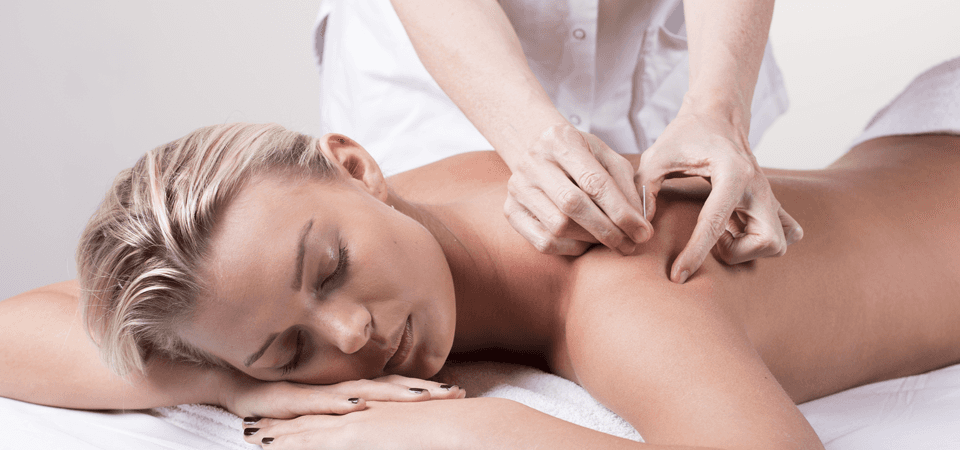 A lady having acupuncture