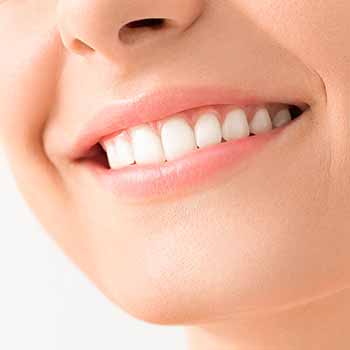 Beautiful smile - Teeth whitening in Durant, OK Beautiful smile - Teeth whitening in Durant, OK