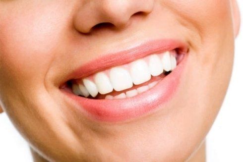 Risoluzione problemi posturali denti