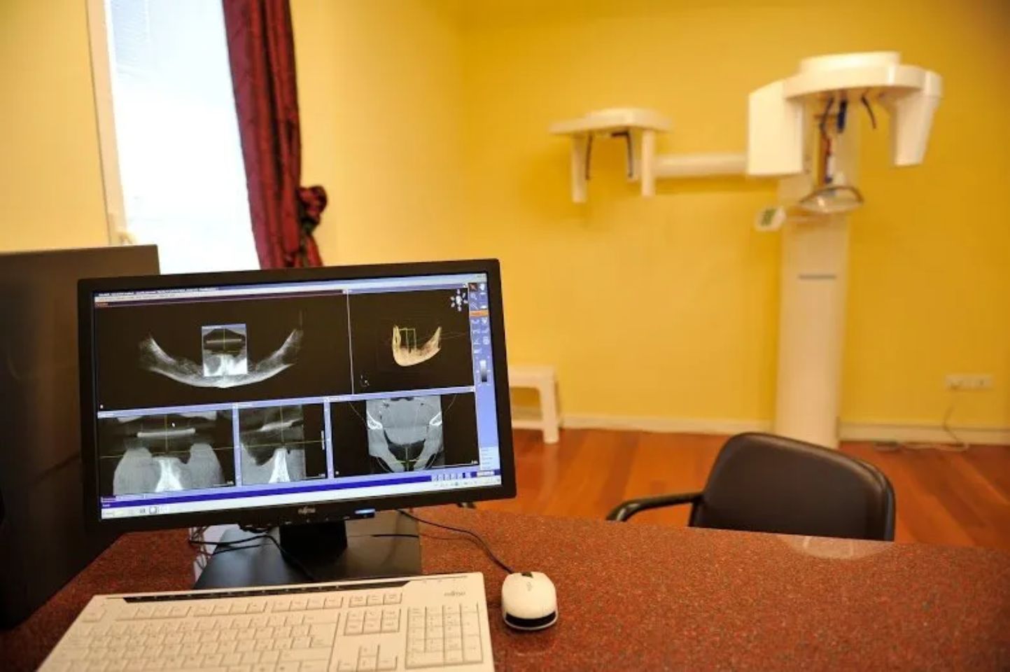 Radiografia dentale