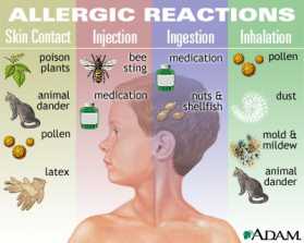 Symptoms - allergy in Framingham, MA Symptoms - allergy in Framingham, MA