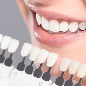 Dental Crowns — Tooth Appearance in Bonita Springs, FL Dental Crowns — Tooth Appearance in Bonita Springs, FL