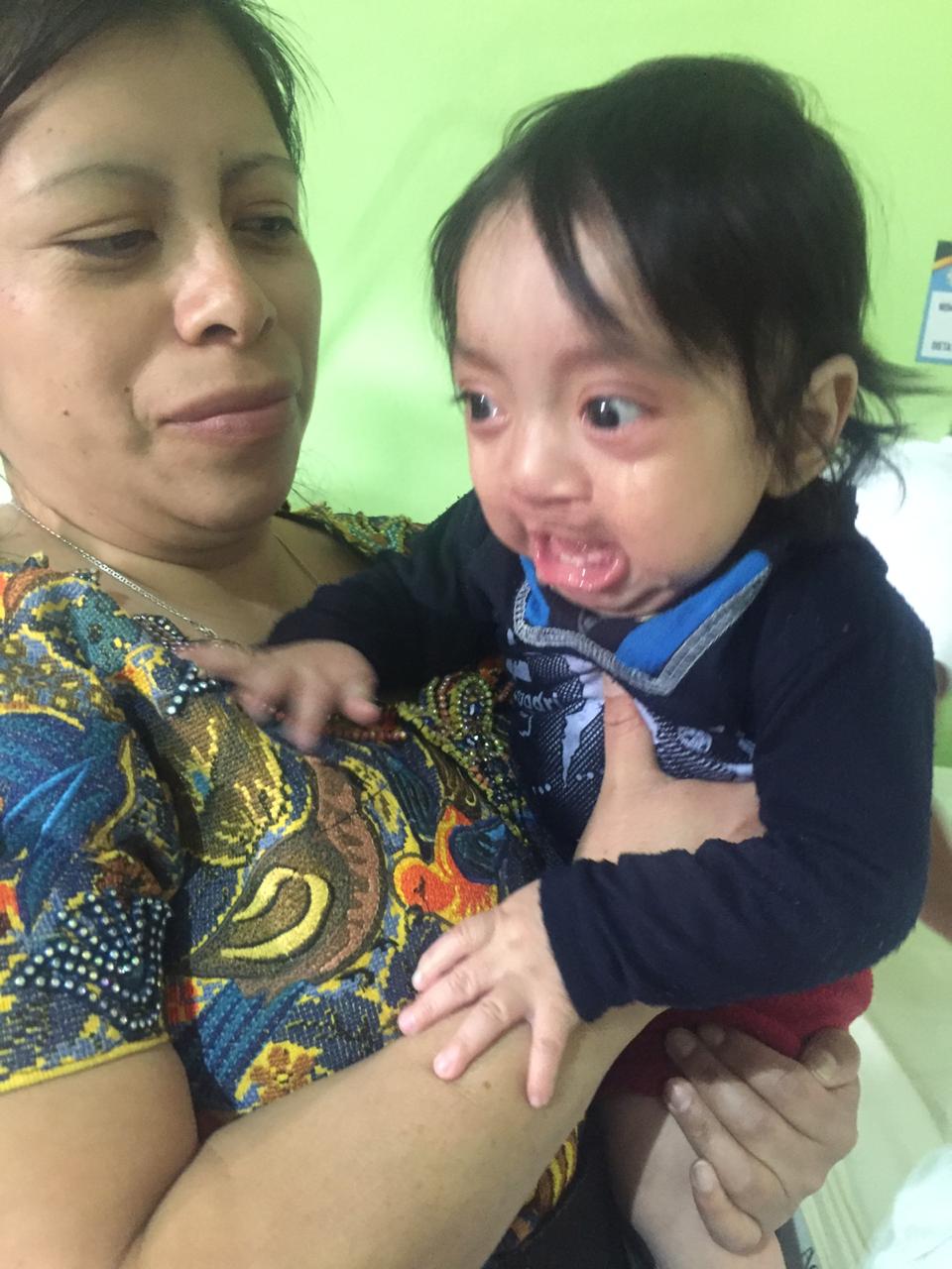 Eine Frau hält ein Kind mit einer Krankheit im Arm. Das Kind hat den Mund geöffnet, die Augen sind weit aufgerissen
