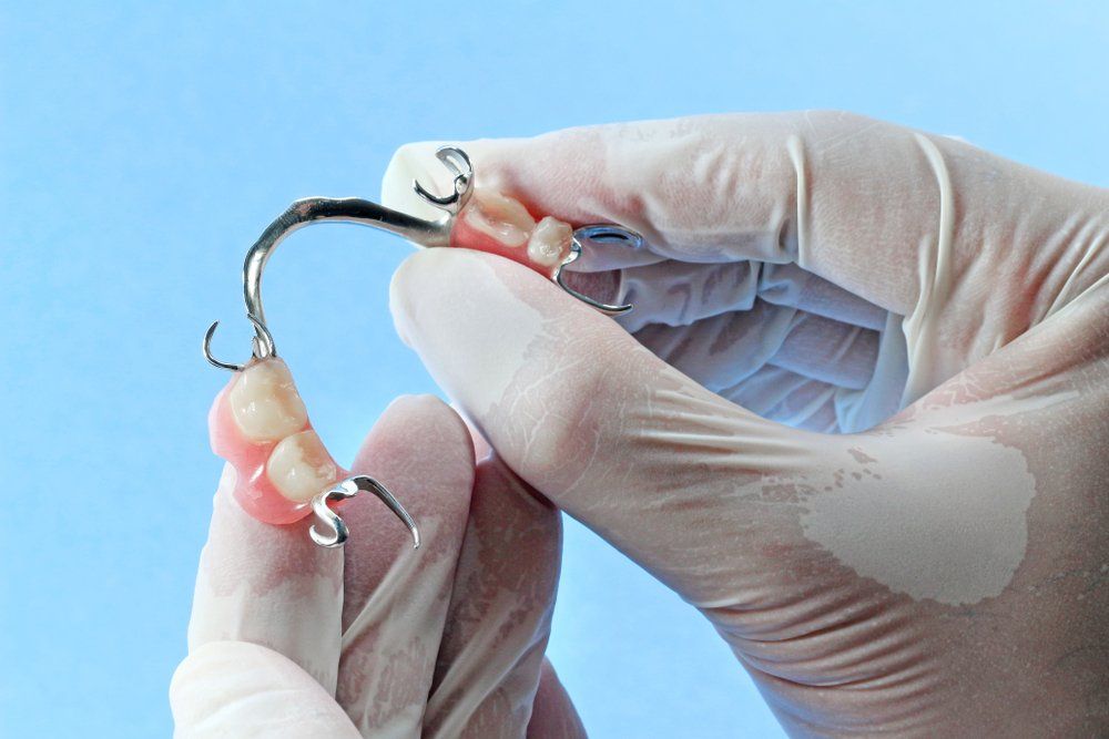New Partial Denture — Ballina Denture Clinic Michael J Parker in Ballina, NSW