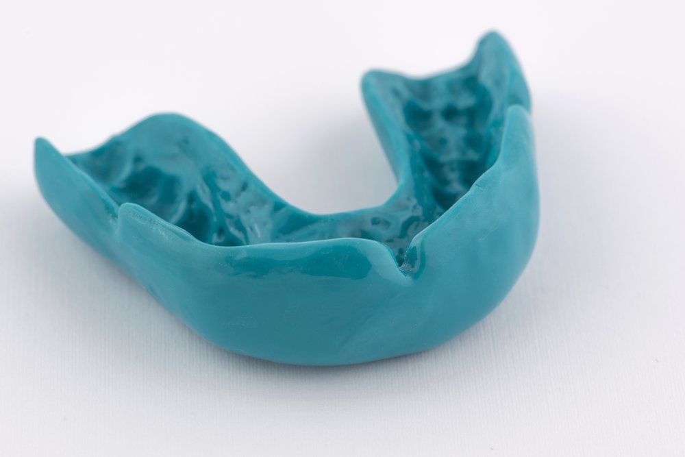 Blue Mouthguard — Ballina Denture Clinic Michael J Parker in Ballina, NSW