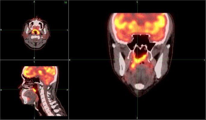 Chiropractic Proves More Effective Than Medical Care For Spinal, Hip and Shoulder Pain
