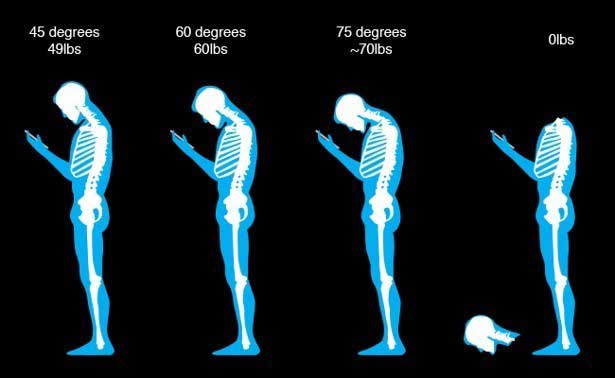 Should I Go to a Chiropractor After a Car Accident in St. Pete, FL