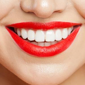 Woman in red lipstick — Wyoming, MI — Dental South Woman in red lipstick — Wyoming, MI — Dental South