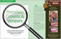 Porcelain crowns and veneers article — Wyoming, MI — Dental South Porcelain crowns and veneers article — Wyoming, MI — Dental South
