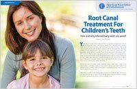 Root canal treatment for children's teeth article — Wyoming, MI — Dental South Root canal treatment for children's teeth article — Wyoming, MI — Dental South