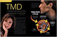 TMD the great impostor article — Wyoming, MI — Dental South TMD the great impostor article — Wyoming, MI — Dental South
