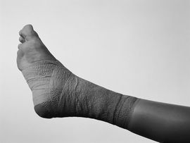 Podiatry — Wound Care in Laredo, TX