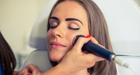 Microdermabrasion treatment