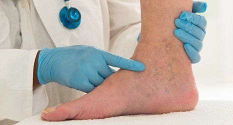 Vascular treatment