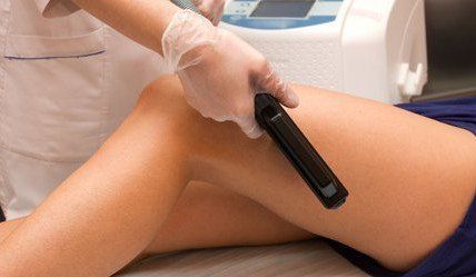 laser treatment on legs