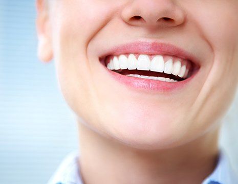 Smiling with White Teeth — Richardson, TX — Mark L. Ethridge, DDS Smiling with White Teeth — Richardson, TX — Mark L. Ethridge, DDS
