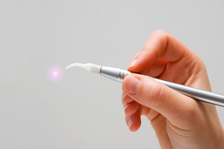 laser gum therapy