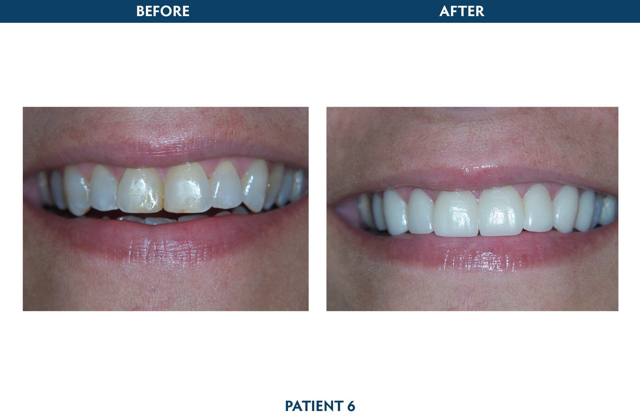sedation dentistry scarsdale, ny