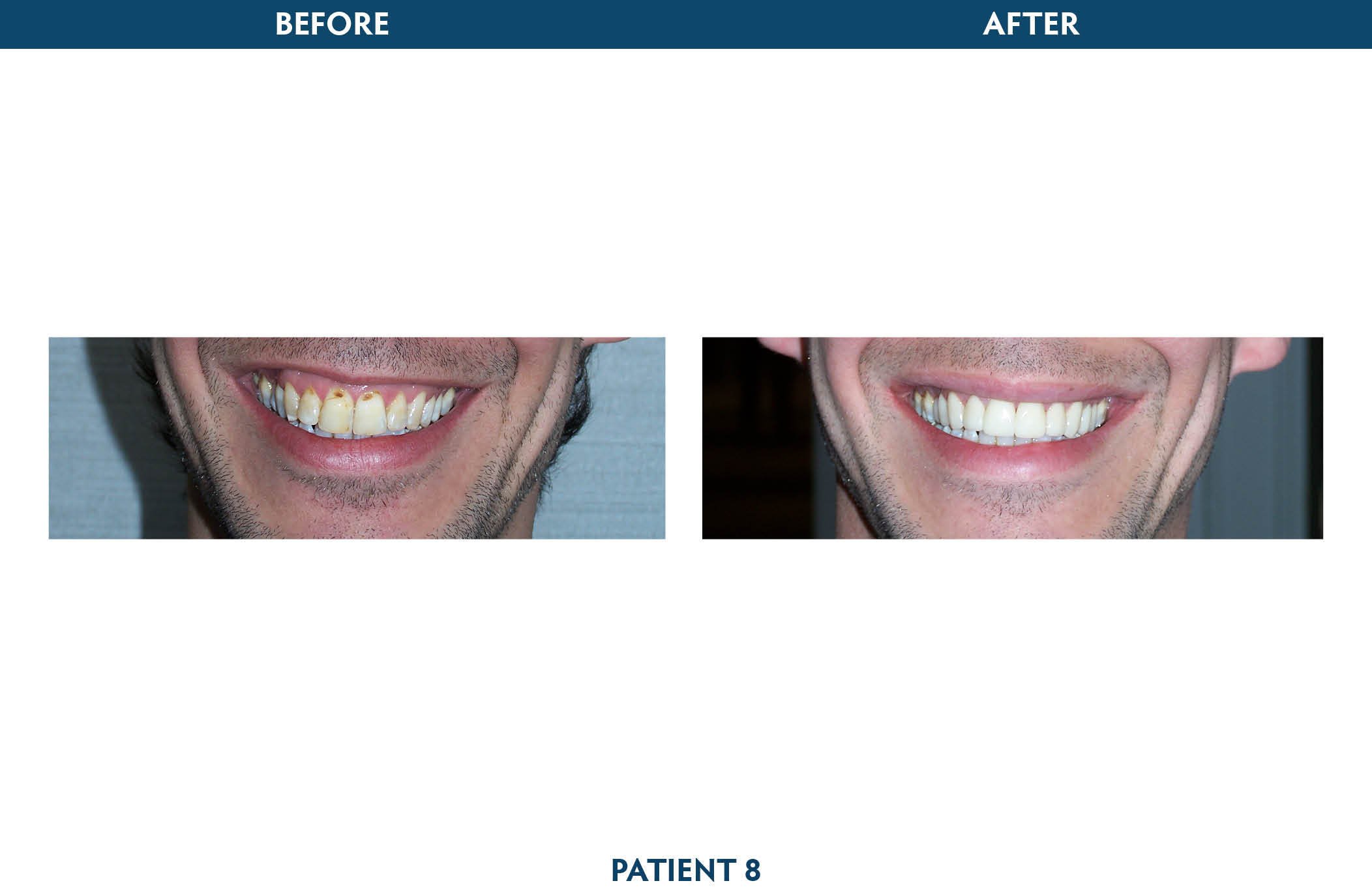 family dentist white plains, ny