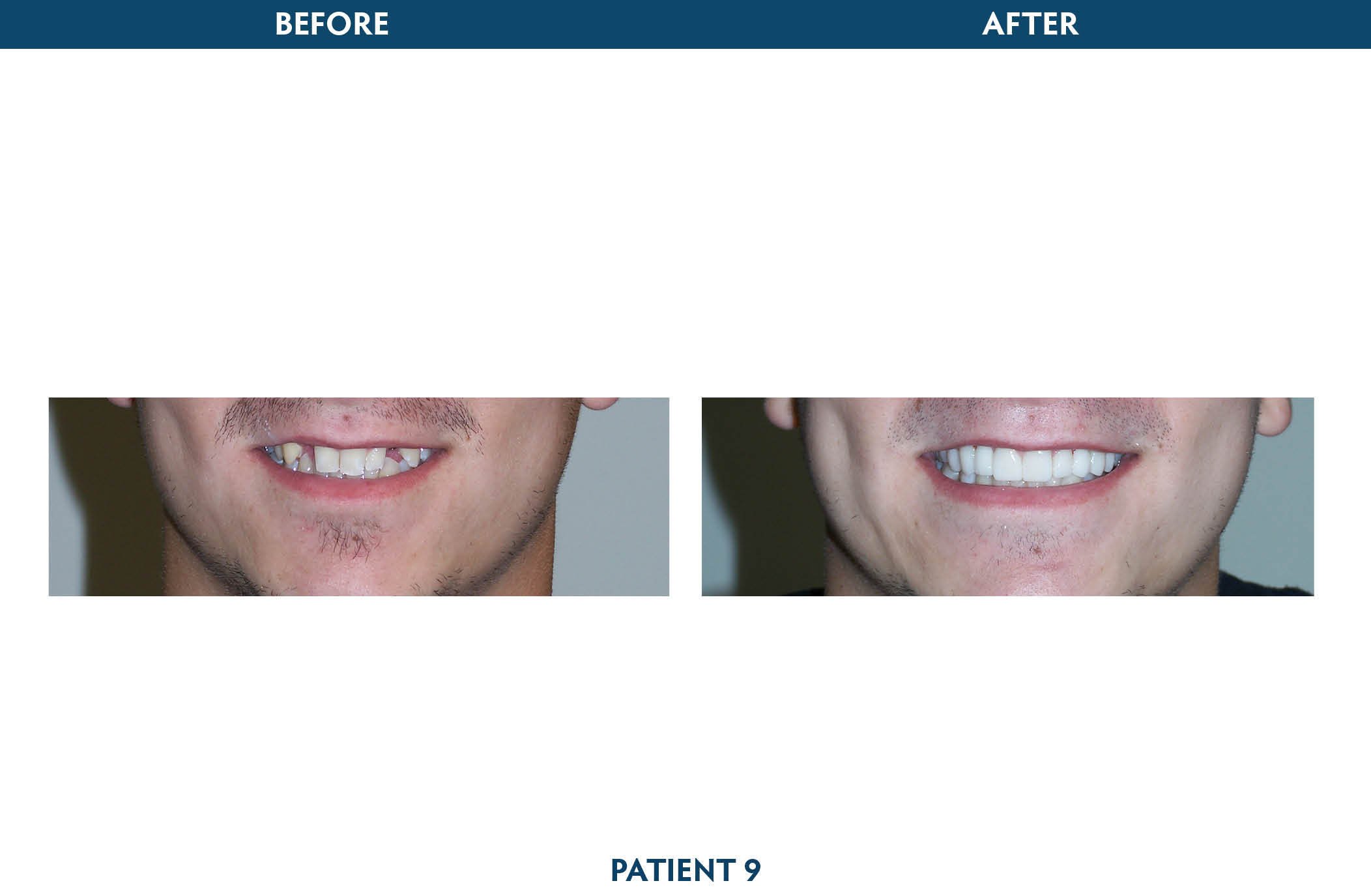 teeth whitening white plains, ny