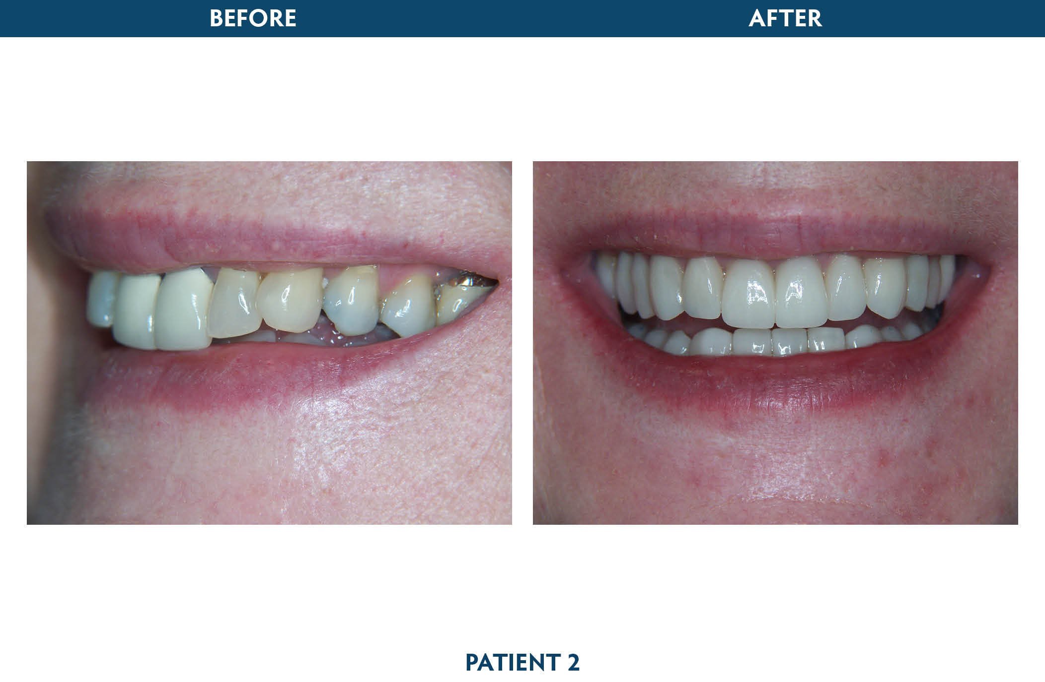 sedation dentistry white plains, ny