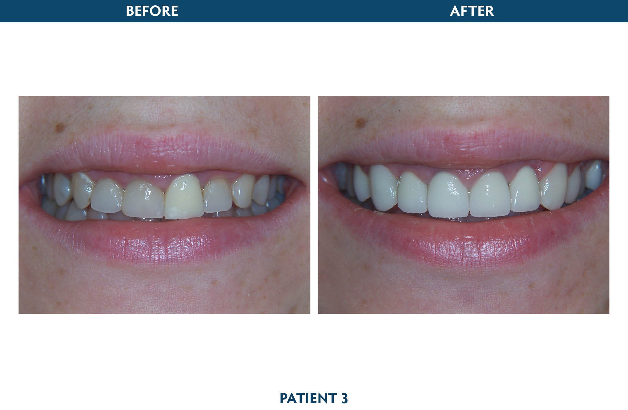 restorative dentistry white plains, ny