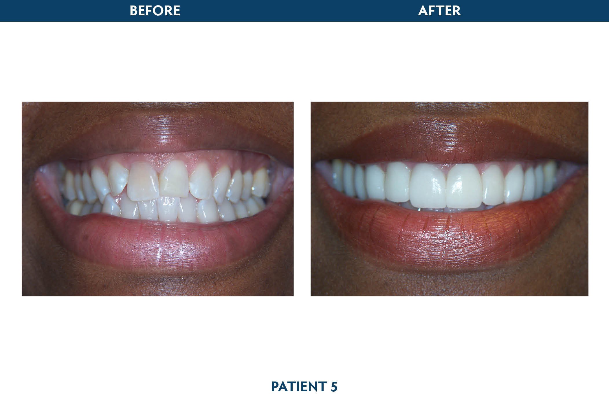 laser dentistry white plains, ny