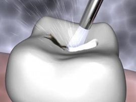 teeth whitening white plains, ny