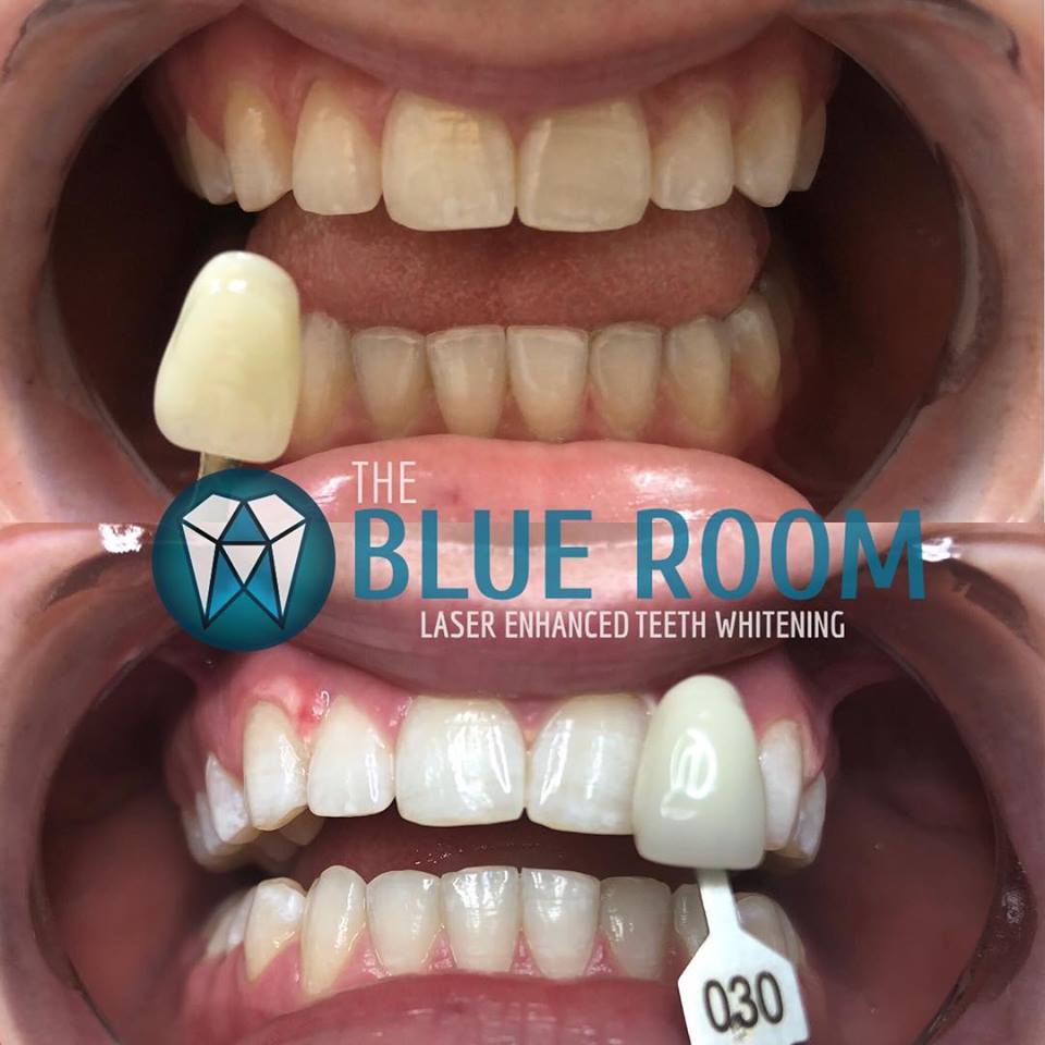blue room before & after 1