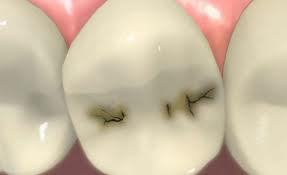 family dentist scarsdale, ny