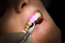 sedation dentistry scarsdale, ny