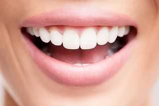 Dental Implants Scarsdale NY