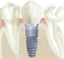restorative dentistry scarsdale, ny
