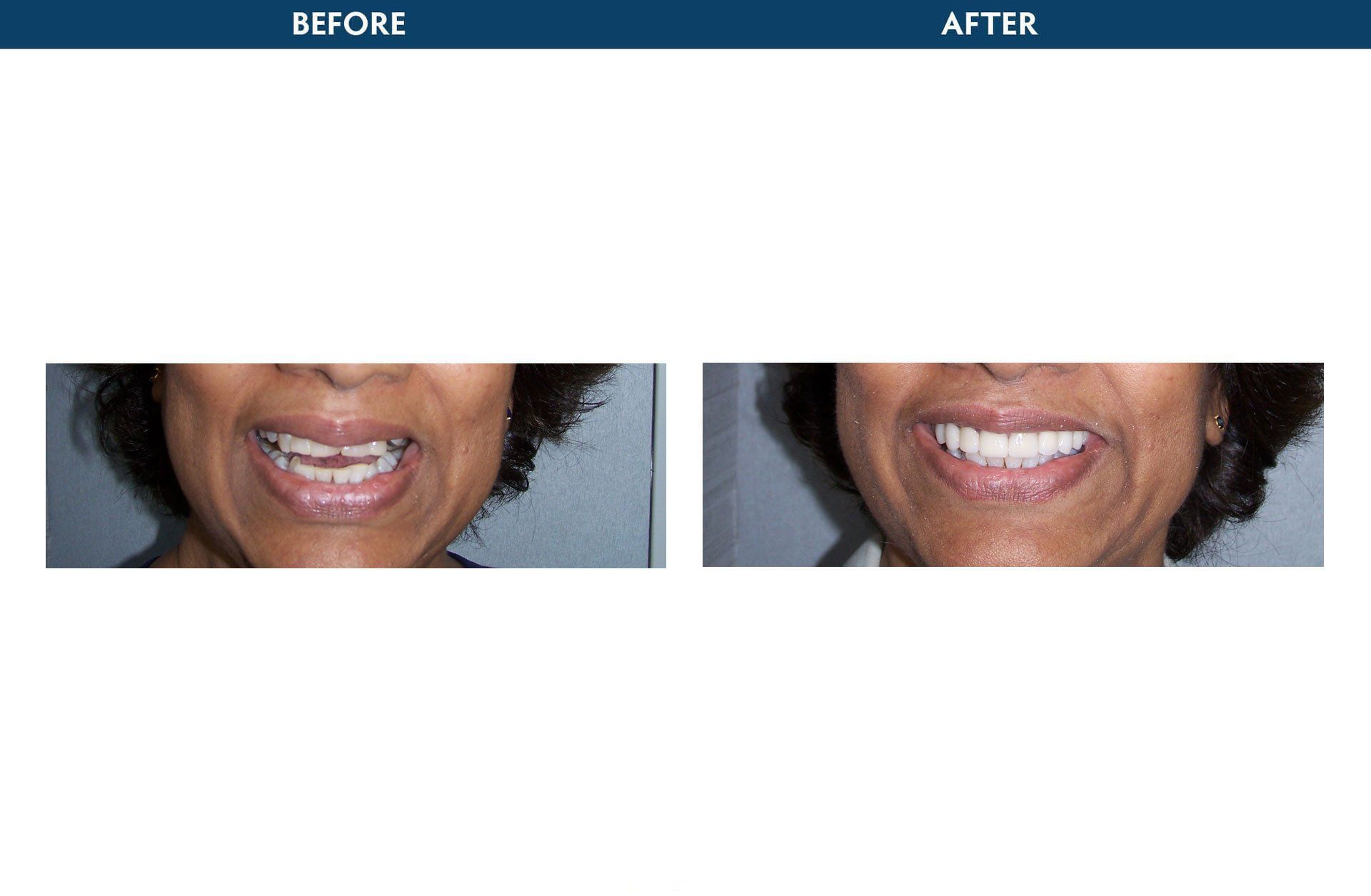 periodontics elmsford, ny