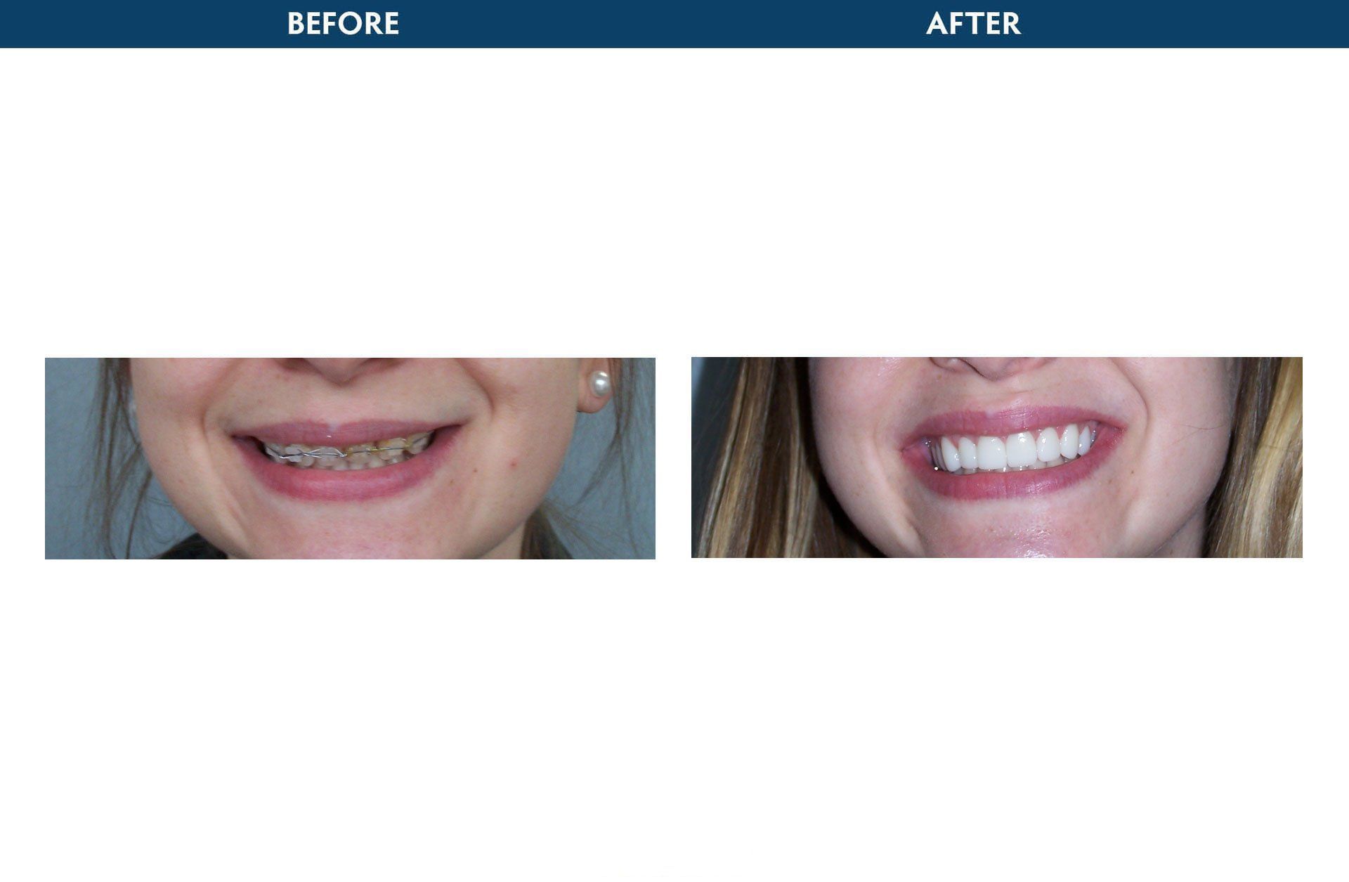 periodontics elmsford, ny