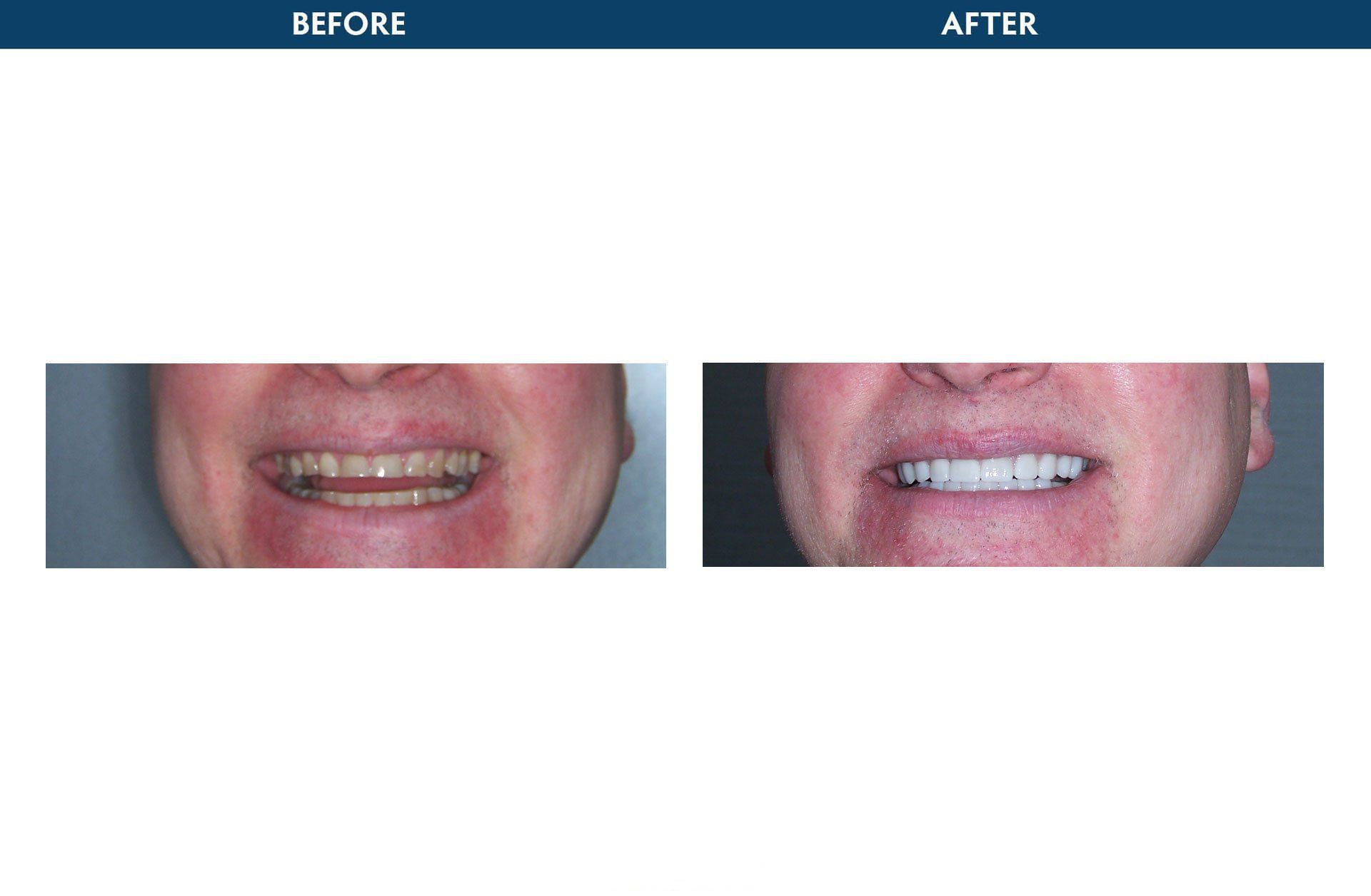 laser dentistry elmsford, ny