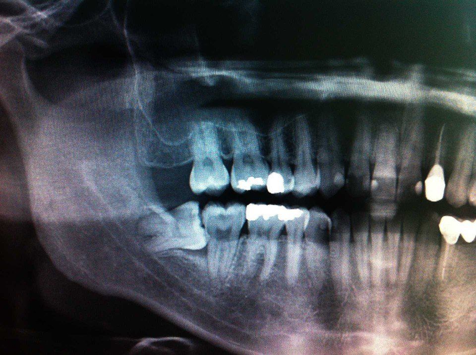 Radiologia odontoiatrica