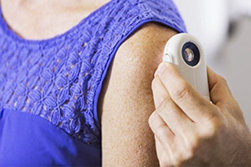 dermatologo controlla la pelle di una donna