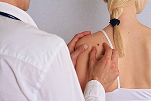 dermatologo durante il controllo nei