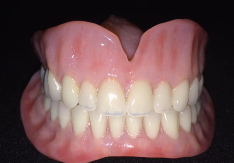 fake set of teeth