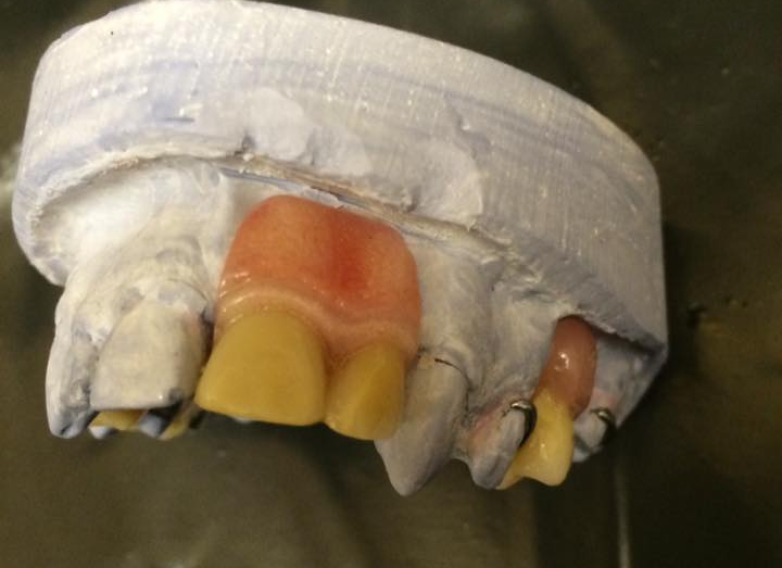 teeth mould with fake teeth