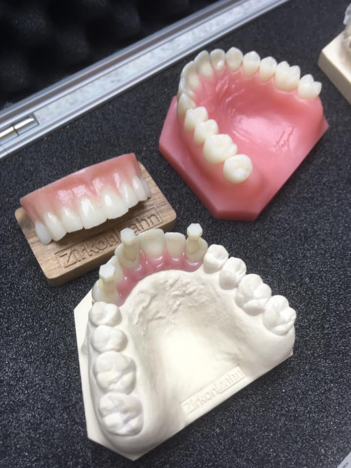 denture mould
